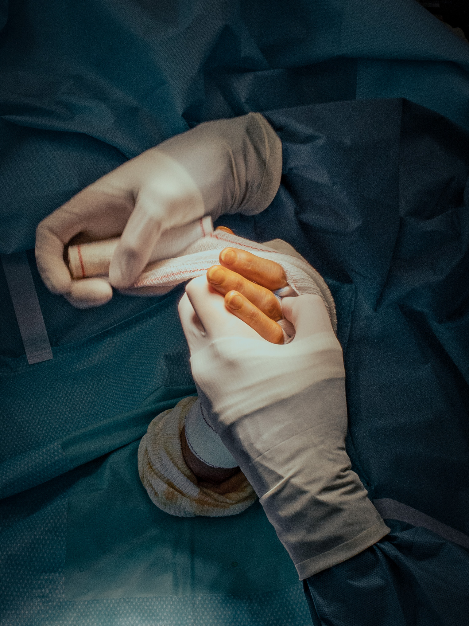 3 months in a surgery room.